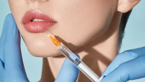 Lip Filler Procedure