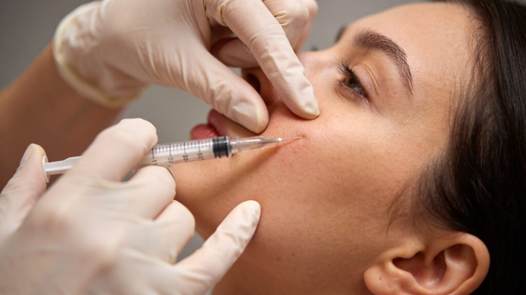 All About Dermal Fillers